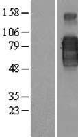 CD200R (CD200R1) Human Over-expression Lysate