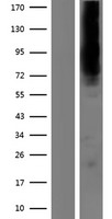 KCNN2 Human Over-expression Lysate