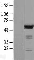 CAMK2D Human Over-expression Lysate