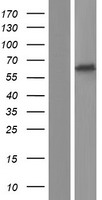 P2X2 (P2RX2) Human Over-expression Lysate