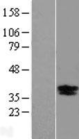 BDNF Human Over-expression Lysate