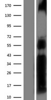 NFAT1 (NFATC2) Human Over-expression Lysate