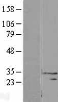 DNAAF6 Human Over-expression Lysate