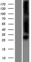 Endonuclease V (ENDOV) Human Over-expression Lysate