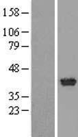 Clavesin 1 (CLVS1) Human Over-expression Lysate