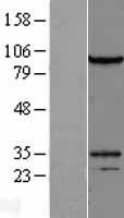 DZIP1L Human Over-expression Lysate