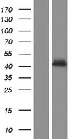P2X2 (P2RX2) Human Over-expression Lysate
