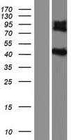 IL5RA Human Over-expression Lysate