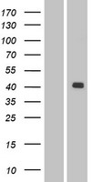 LMX1A Human Over-expression Lysate