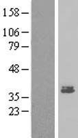 MEST Human Over-expression Lysate