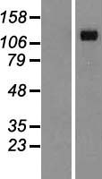 Desmoglein 4 (DSG4) Human Over-expression Lysate