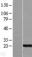 ARL6 Human Over-expression Lysate