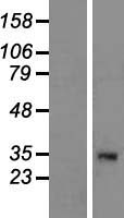 C1QTNF9 Human Over-expression Lysate