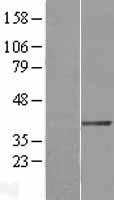 DTX3 Human Over-expression Lysate