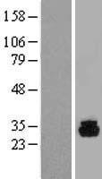 PHOSPHO1 Human Over-expression Lysate