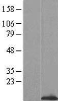 OST beta (SLC51B) Human Over-expression Lysate