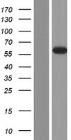 WDR20 Human Over-expression Lysate