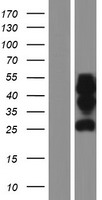 Protor 1 (PRR5) Human Over-expression Lysate