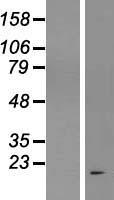 C17orf58 Human Over-expression Lysate