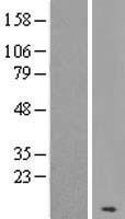 KRTAP19-7 Human Over-expression Lysate