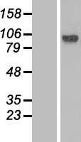 Lebercilin (LCA5) Human Over-expression Lysate