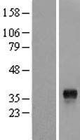 GEM Human Over-expression Lysate