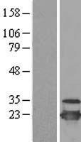 UBE2C Human Over-expression Lysate
