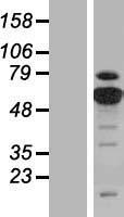 PKM2 (PKM) Human Over-expression Lysate