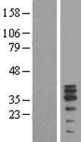 MAGEB10 Human Over-expression Lysate