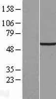 TCTE1 Human Over-expression Lysate