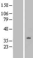 Nociceptin receptor (OPRL1) Human Over-expression Lysate