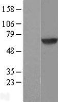 Dystrobrevin beta (DTNB) Human Over-expression Lysate