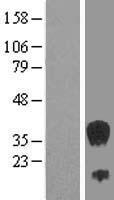 SEC13L1 (SEC13) Human Over-expression Lysate
