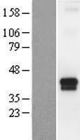 TMPRSS4 Human Over-expression Lysate