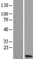 NMES1 (C15orf48) Human Over-expression Lysate