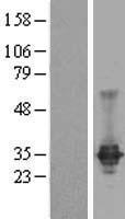 Claudin 23 (CLDN23) Human Over-expression Lysate