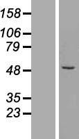 ZFP200 (ZNF200) Human Over-expression Lysate