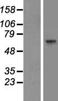 ARSK Human Over-expression Lysate