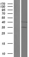 UQCC (UQCC1) Human Over-expression Lysate