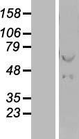 Hsp60 (HSPD1) Human Over-expression Lysate