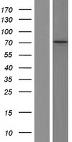 CACNB2 Human Over-expression Lysate