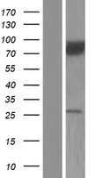CACNB2 Human Over-expression Lysate