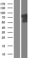 CACNB2 Human Over-expression Lysate