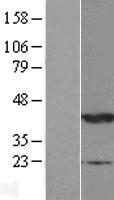 NDRG2 Human Over-expression Lysate