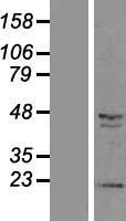 CBWD3 Human Over-expression Lysate