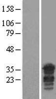 PPHLN1 Human Over-expression Lysate
