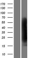 Clusterin (CLU) Human Over-expression Lysate