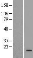 ZNF321P Human Over-expression Lysate