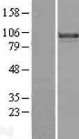 FOXM1 Human Over-expression Lysate