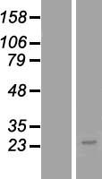 TMEM179B Human Over-expression Lysate